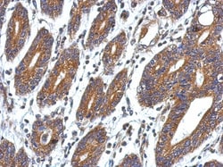CCDC127 Antibody, Novus Biologicals 0.1 mL | Buy Online | Novus Biologicals | Fisher Scientific