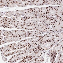 CCDC12 Antibody, Novus Biologicals 25 &mu;L, Unlabeled:Antibodies, Polyclonal
