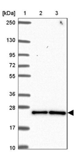 CCDC12 Antibody, Novus Biologicals 25 &mu;L, Unlabeled:Antibodies, Polyclonal
