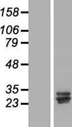 Novus Biologicals&trade;&nbsp;CCDC134 Overexpression Lysate