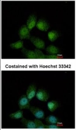 CCDC14 Antibody, Novus Biologicals 0.1mL; Unlabeled:Antibodies, Polyclonal