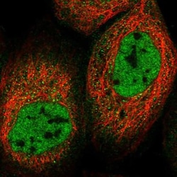 CCDC140 Antibody, Novus Biologicals:Antibodies:Primary Antibodies