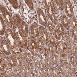 CCDC140 Antibody, Novus Biologicals:Antibodies:Primary Antibodies