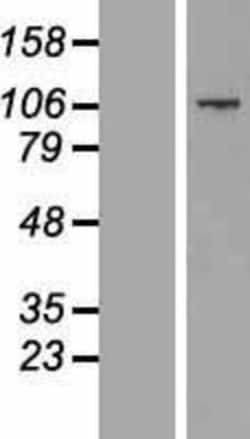 Novus Biologicals&trade;&nbsp;CCDC141 Overexpression Lysate