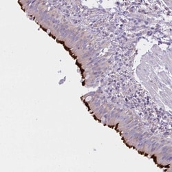 CCDC142 Antibody, Novus Biologicals 0.1mL; Unlabeled:Antibodies, Polyclonal