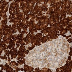 CCDC144A Antibody, Novus Biologicals 25 &mu;L, Unlabeled:Antibodies, Polyclonal