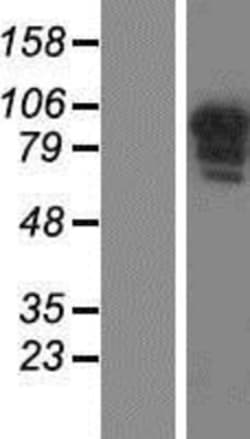 Novus Biologicals&trade;&nbsp;CCDC144B Overexpression Lysate