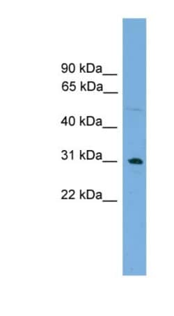 CCDC144NL Antibody, Novus Biologicals 100&mu;L; Unlabeled:Antibodies, Polyclonal