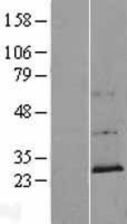 Novus Biologicals&trade;&nbsp;CCDC144NL Overexpression Lysate