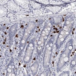 CCDC147 Antibody, Novus Biologicals 25 &mu;L; Unlabeled:Antibodies, Polyclonal