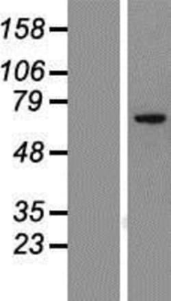 Novus Biologicals™ CCDC151 Overexpression Lysate