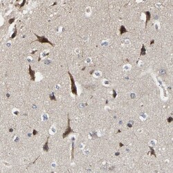 CCDC155 Antibody, Novus Biologicals 0.1mL; Unlabeled:Antibodies, Polyclonal