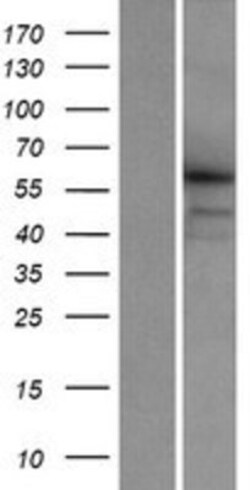 Novus Biologicals&trade;&nbsp;CCDC155 Overexpression Lysate