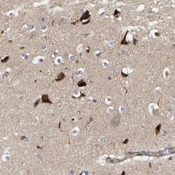 CCDC155 Antibody, Novus Biologicals 0.1mL; Unlabeled:Antibodies, Polyclonal