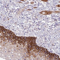 CCDC157 Antibody, Novus Biologicals:Antibodies:Primary Antibodies
