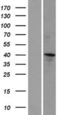 Novus Biologicals&trade;&nbsp;CCDC16 Overexpression Lysate
