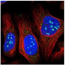 CCDC160 Antibody, Novus Biologicals 0.1mL; Unlabeled:Antibodies, Polyclonal