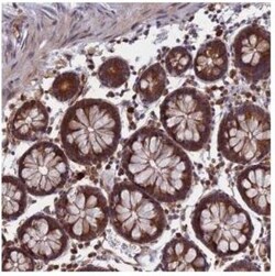CCDC160 Antibody, Novus Biologicals 0.1mL; Unlabeled:Antibodies, Polyclonal