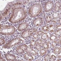 CCDC166 Antibody, Novus Biologicals:Antibodies:Primary Antibodies