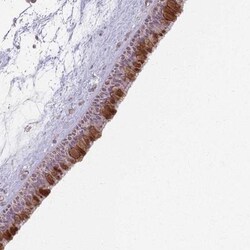 CCDC168 Antibody, Novus Biologicals:Antibodies:Primary Antibodies