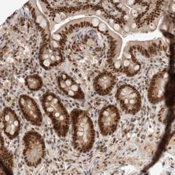CCDC16 Antibody, Novus Biologicals 0.1mL; Unlabeled:Antibodies, Polyclonal