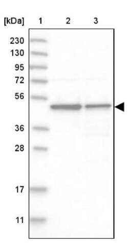 CCDC16 Antibody, Novus Biologicals 0.1mL; Unlabeled:Antibodies, Polyclonal