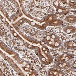 CCDC176 Antibody, Novus Biologicals 0.1mL; Unlabeled:Antibodies, Polyclonal