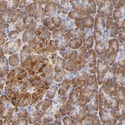 CCDC176 Antibody, Novus Biologicals:Antibodies:Primary Antibodies