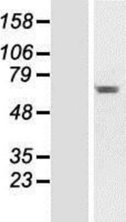 Novus Biologicals&trade;&nbsp;CCDC176 Overexpression Lysate