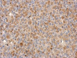 CCDC178 Antibody, Novus Biologicals 0.1mL; Unlabeled:Antibodies, Polyclonal