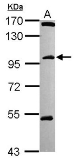 CCDC178 Antibody, Novus Biologicals 0.1mL; Unlabeled:Antibodies, Polyclonal