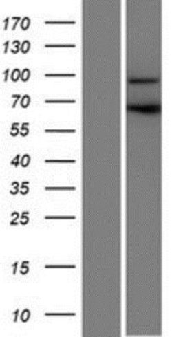 Novus Biologicals&trade;&nbsp;CCDC178 Overexpression Lysate