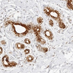CCDC17 Antibody, Novus Biologicals 0.1mL; Unlabeled:Antibodies, Polyclonal