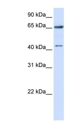 CCDC19 Antibody, Novus Biologicals 100&mu;L; Unlabeled:Antibodies, Polyclonal