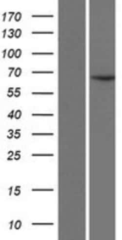 Novus Biologicals&trade;&nbsp;CCDC19 Overexpression Lysate