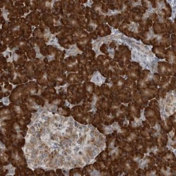 CCDC21 Antibody, Novus Biologicals:Antibodies:Primary Antibodies