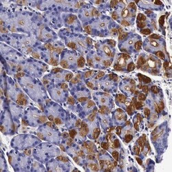 CCDC22 Antibody, Novus Biologicals 0.1mL; Unlabeled:Antibodies, Polyclonal