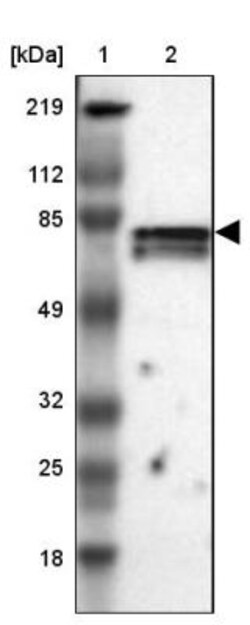 CCDC22 Antibody, Novus Biologicals 0.1mL; Unlabeled:Antibodies, Polyclonal