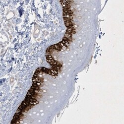 CCDC24 Antibody, Novus Biologicals 25 &mu;L, Unlabeled:Antibodies, Polyclonal