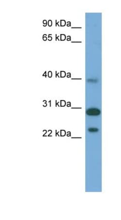 CCDC28A Antibody, Novus Biologicals 100&mu;L; Unlabeled:Antibodies, Polyclonal