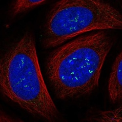 CCDC30 Antibody, Novus Biologicals 0.1mL; Unlabeled:Antibodies, Polyclonal