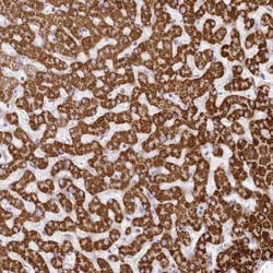 CCDC30 Antibody, Novus Biologicals 25 &mu;L, Unlabeled:Antibodies, Polyclonal