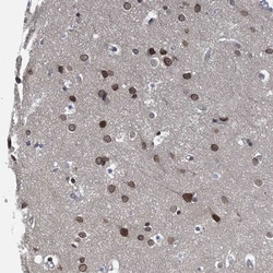 CCDC34 Antibody, Novus Biologicals 25 &mu;L, Unlabeled:Antibodies, Polyclonal