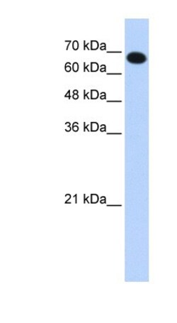 CCDC38 Antibody, Novus Biologicals 20 &mu;L | Buy Online | Novus Biologicals | Fisher Scientific