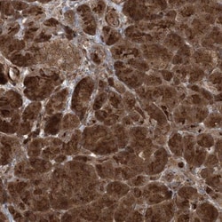 CCDC39 Antibody, Novus Biologicals 0.1mL; Unlabeled:Antibodies, Polyclonal