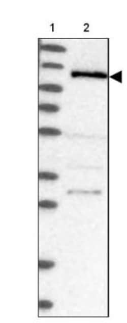 CCDC39 Antibody, Novus Biologicals 0.1mL; Unlabeled:Antibodies, Polyclonal
