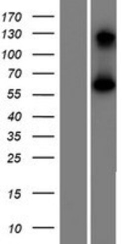 Novus Biologicals™ CCDC4 Overexpression Lysate
