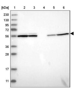 CCDC40 Antibody, Novus Biologicals 0.1mL; Unlabeled:Antibodies, Polyclonal
