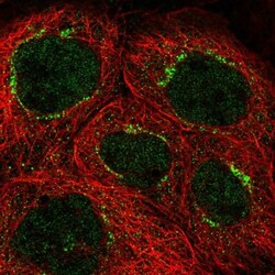 CCDC41 Antibody, Novus Biologicals 0.1mL; Unlabeled:Antibodies, Polyclonal