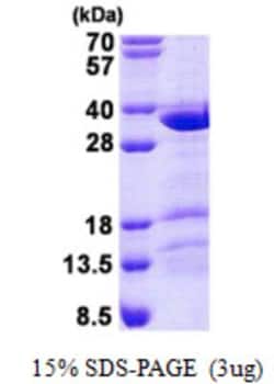 Novus Biologicals&trade;&nbsp;Recombinant Human CCDC43 His Protein